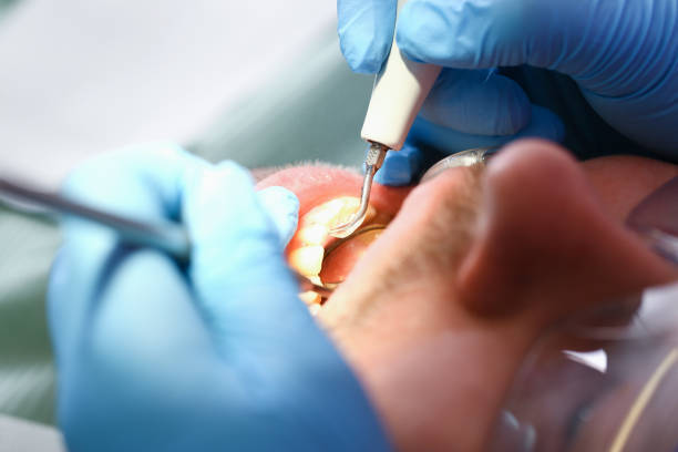 Best Emergency Dental Services for Seniors in Decorah, IA